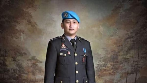 Kabar Autopsi Ulang Brigadir J, Organ Otak Pindah Ke Perut