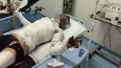 Sumur Minyak Meledak