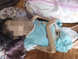 Ayatul Aula Bocah yang Mengalami Penyakit Misterius