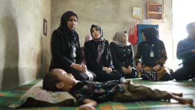 Idap Penyakit Hydrocephalus, Bocah Miskin di Nagan Raya Butuh Bantuan