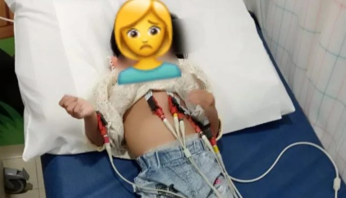 Kisah Shanum, Bocah 2 Tahun Idap Bocor Jantung Butuh Uluran Tangan Dermawan