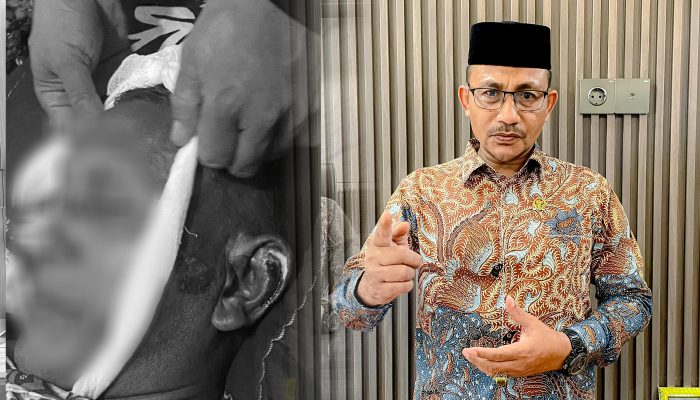 Warga Aceh Utara Meninggal Dunia Diduga Akibat Dianiaya Oknum Polisi, Haji Uma Minta Polda Aceh Tangani Serius